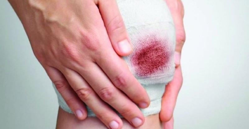 Mơ Thấy Máu Kinh Nguyệt Của Mình Là Điềm Gì? 3 Mơ thấy máu kinh nguyệt: Các trường hợp cụ thể