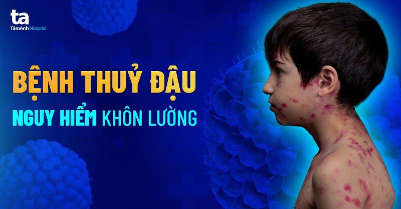 Người phụ nữ có con ong đậu trên tay