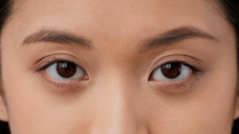 Giật lông mày phải do căng thẳng