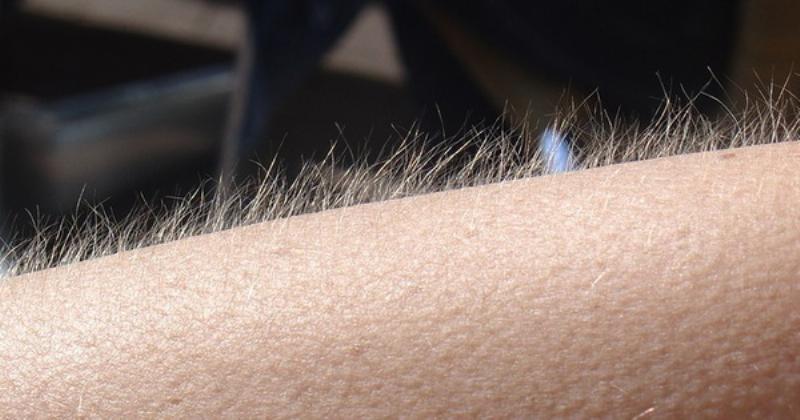 Nổi da gà khi nghe nhạc