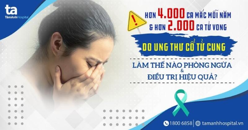 Xem Cung Phu Thê Theo Ngày Tháng Năm Sinh Chính Xác 4 Ý Nghĩa Cung Phu Thê Trong Tử Vi: Biểu Đồ Thống Kê