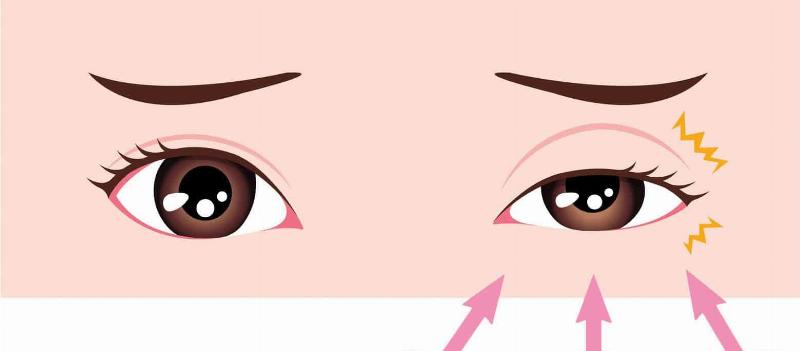 Mắt Trái Nam Giật Hên Hay Xui: Giải Mã Bí Ẩn Dân Gian 3 Mắt trái giật nhiều hơn mắt phải: Sự thật hay quan niệm?