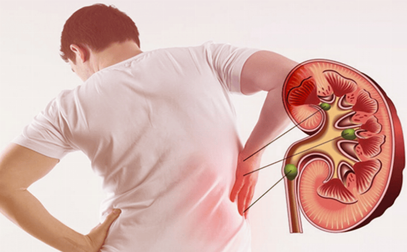 Phương Pháp Loại Bỏ Râu Mèo