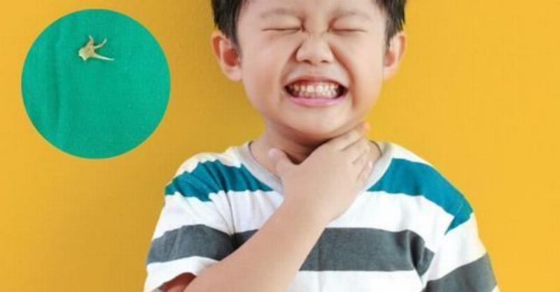 Cách Chữa Hóc Xương Cá: Mẹo Vặt và Giải Pháp Hiệu Quả 2 Nuốt cơm, chuối, giấm chữa hóc xương cá